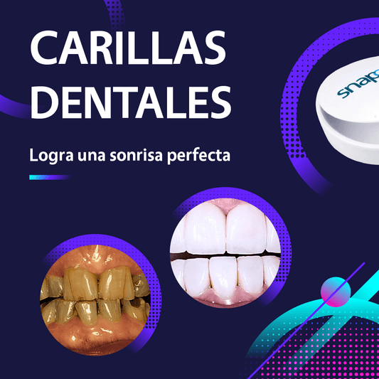 Carillas Dentales Importadas – Sonríe con Confianza - OFERTA 3X1 SOLO POR HOY